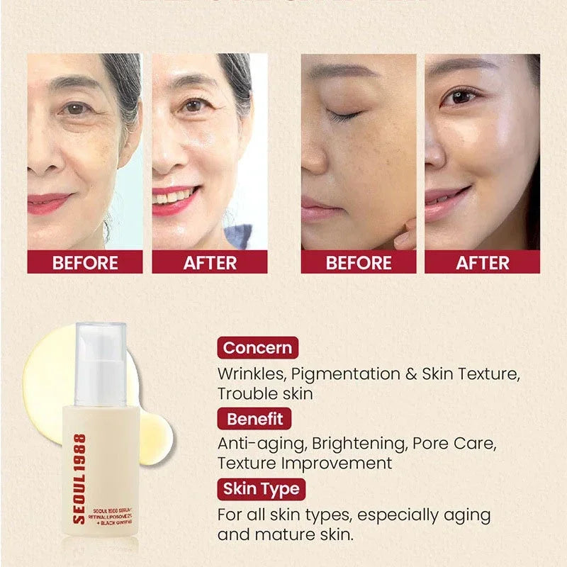 Sérum Rétinol Visage SEOUL 1988 + Crème Contour des Yeux – Anti-Âge, Anti-Rides, Ginseng Noir 2%, Rétinal Liposome 4%
